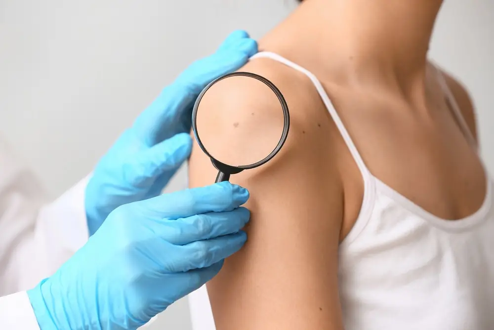 A dermatoscope examination during a full-body skin check.